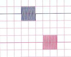 osscillogramme
