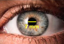 oeil